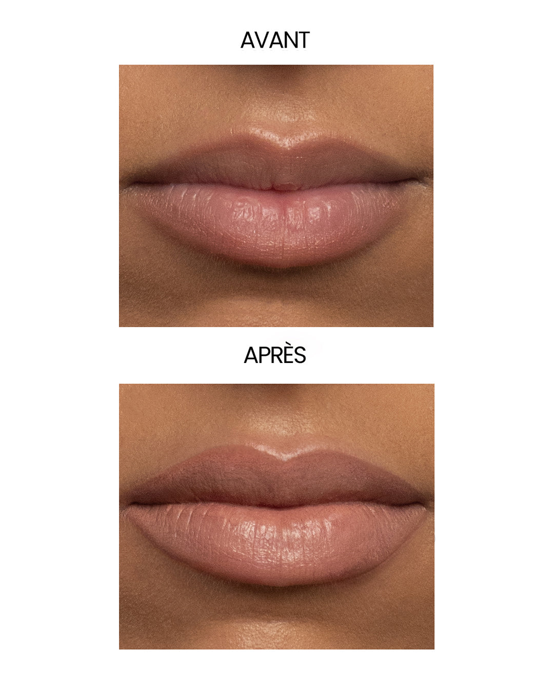 La Recharge Exception